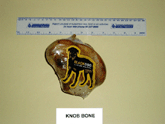 Knob Bone