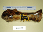 Shin Bone